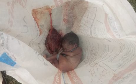 Catador encontra feto de criança enterrado no lixo em Belford Roxo