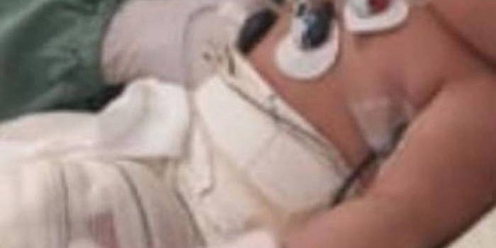 Funcionária envolvida em queimadura de bebê vai responder por lesão corporal