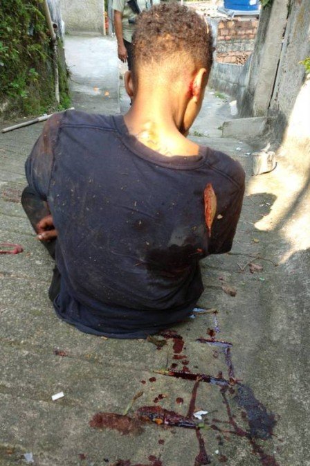 Jovem torturado é resgatado pela Polícia Civil dentro do comunidade em Niterói
